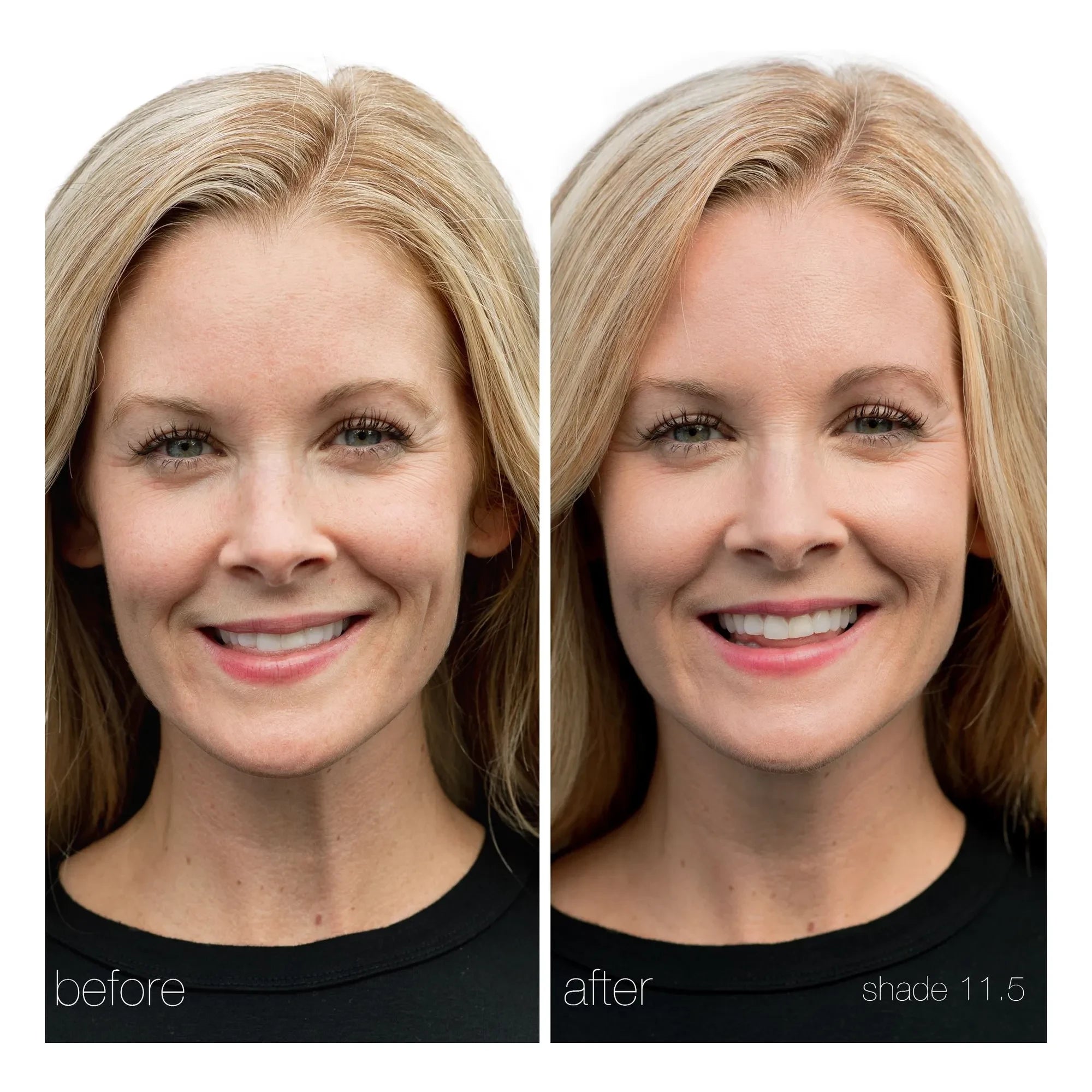 RMS Beauty - UnCoverup Corrector - 5,67 g | 11,5