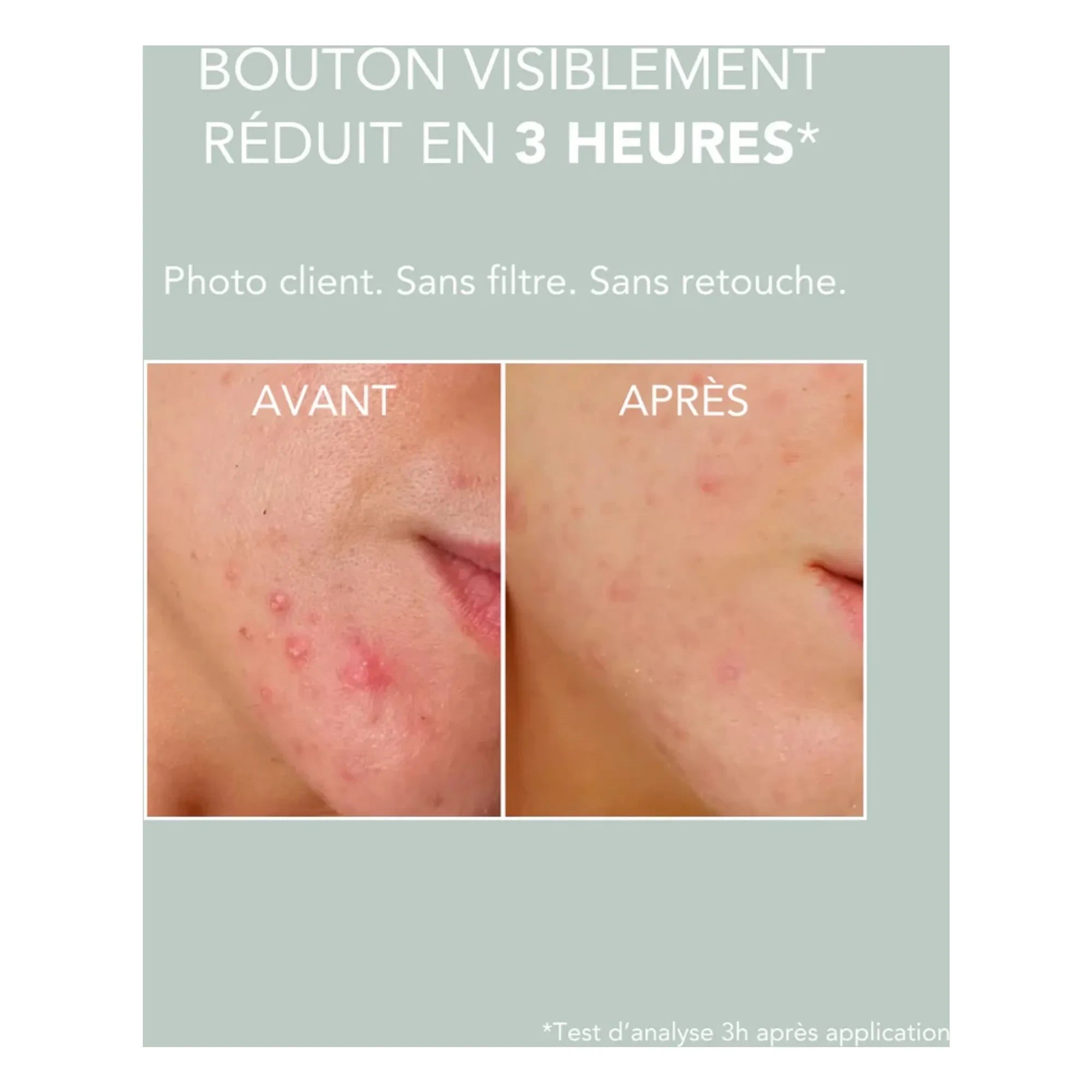 On The Wild Side - Pastel de botón de Stop