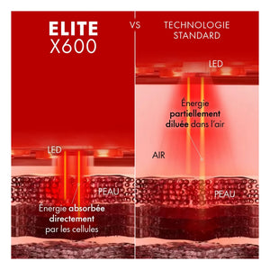 Nooance - Mascarilla facial LED Elite X600